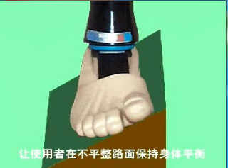 万向踝假肢