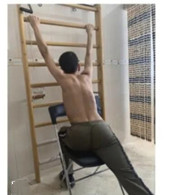 体操训练对脊柱侧弯患者的重要性