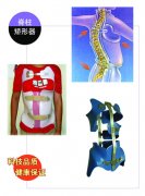 脊柱侧弯矫形器
