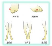 下肢病例名称