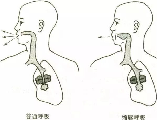 脊柱侧弯的呼吸加支具