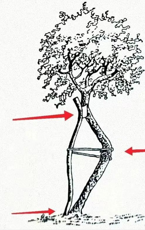 脊柱侧弯矫形器(支具)  