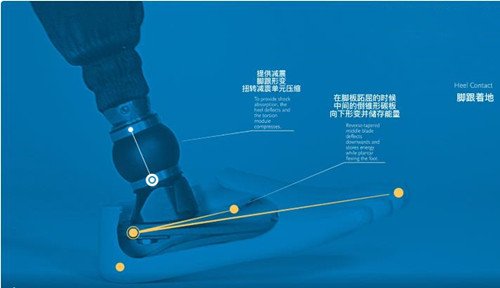 低外型碳纤徦脚飞毛腿