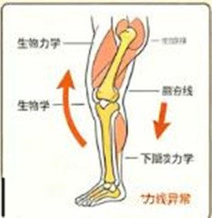 足踝、足底问题找矫形康复专家